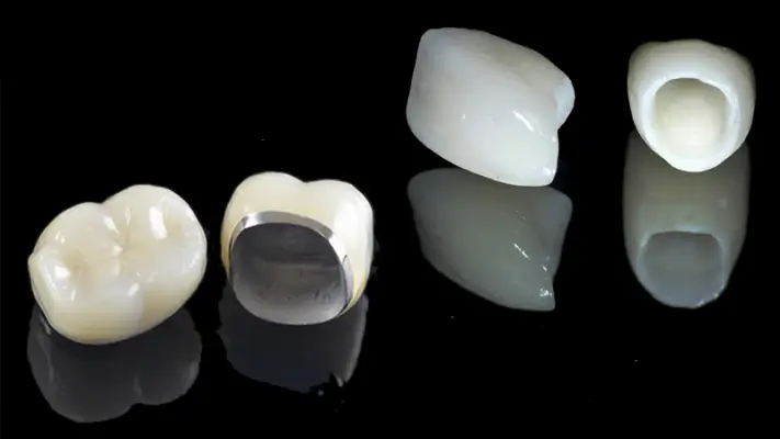 Răng sứ kim loại