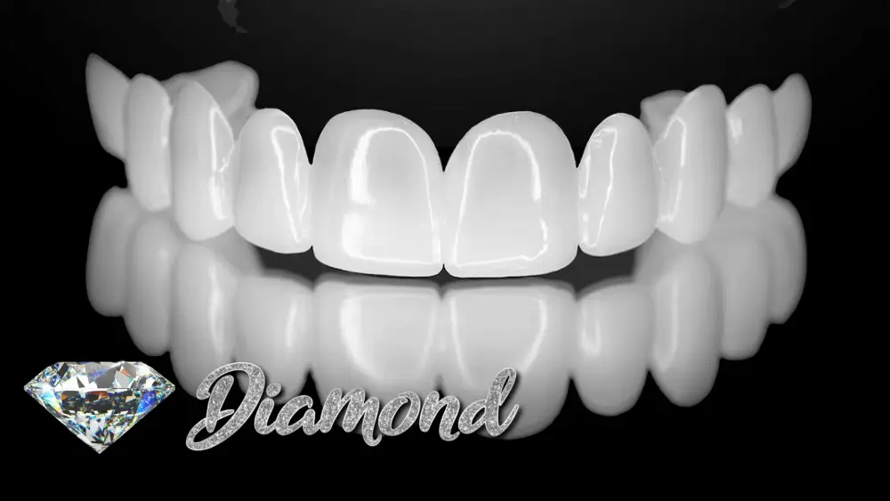 Răng toàn sứ Cercon Diamond